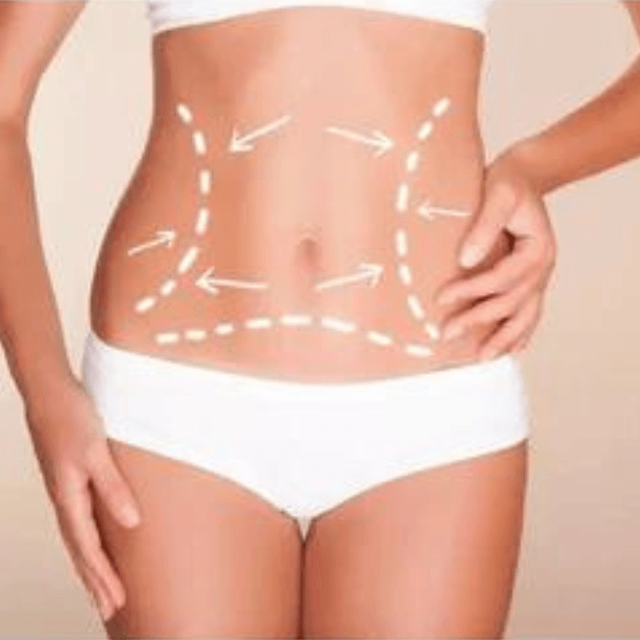 Surgeon Approved 360 Lipo Recovery Kit Post-Op