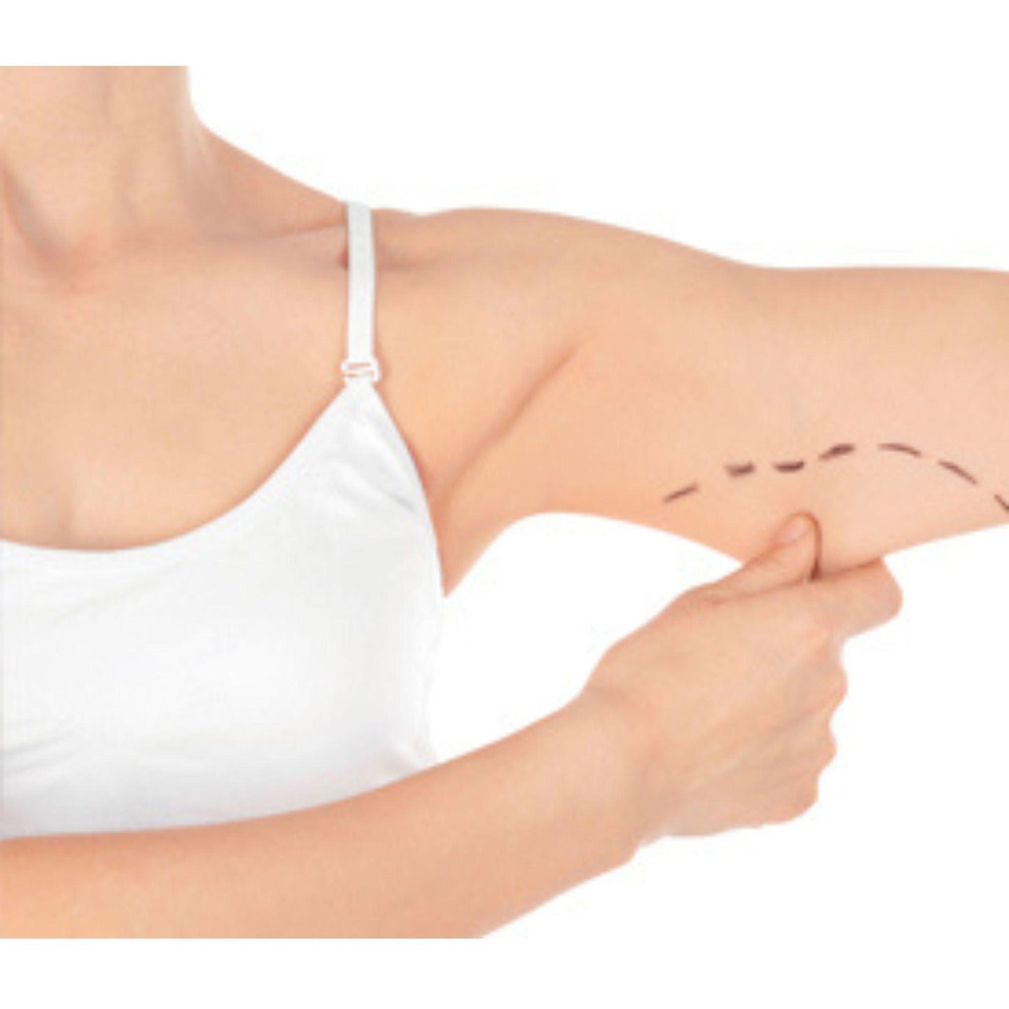 Arm lift brachioplasty recovery kit complete post-op set with medical supplies and activity workbook