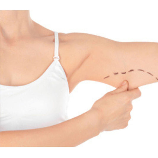 Medical-grade arm lift brachioplasty post-op recovery kit, comprehensive supplies, professional healthcare support