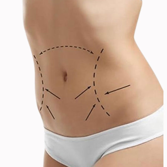 Medical-grade tummy tuck recovery kit 23-piece abdominoplasty post-operative comprehensive supplies professional