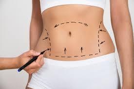 Are Mixed Emotions Normal After Tummy Tuck?