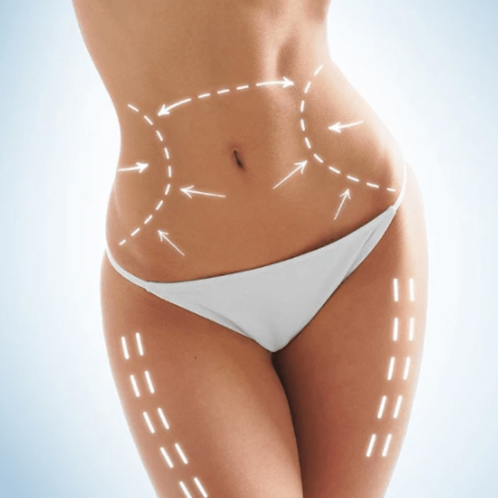 Medical-grade tummy tuck BBL recovery kit for cosmetic surgery procedures. Professional supplies for abdominoplasty, Brazilian butt lift, and liposuction.